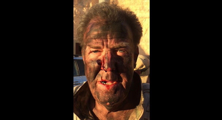  Jeremy Clarkson Tweets Bloody Photo, Says He Survived Dangerous Stunt